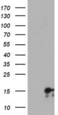 Western Blot: SYNJ2BP/ARIP2 Antibody (OTI3A9)Azide and BSA Free [NBP2-74417]