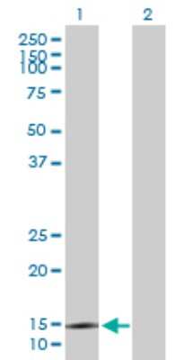 Western Blot: SYNJ2BP/ARIP2 Antibody [H00055333-B01P]