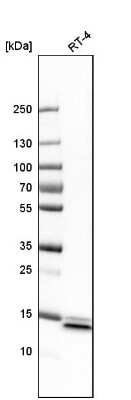 Western Blot: SYNJ2BP/ARIP2 Antibody [NBP1-88985]