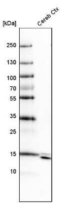 Western Blot: SYNJ2BP/ARIP2 Antibody [NBP1-88985]