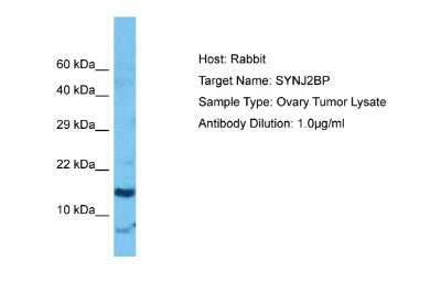 Western Blot: SYNJ2BP/ARIP2 Antibody [NBP2-88393]