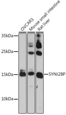 Western Blot: SYNJ2BP/ARIP2 AntibodyAzide and BSA Free [NBP2-94820]