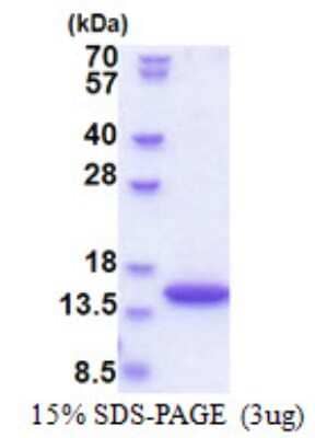 SDS-PAGE: Recombinant Human SYNJ2BP/ARIP2 His Protein [NBP2-51584]