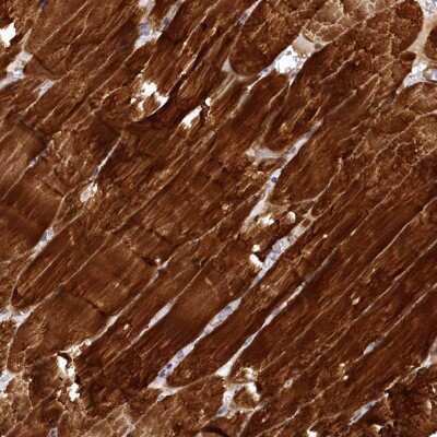 Immunohistochemistry: SYNPO2 Antibody [NBP2-48595]