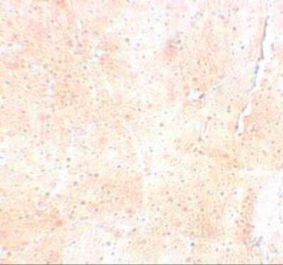 Immunohistochemistry-Paraffin: SYNPO2 Antibody - BSA Free [NBP2-82037]