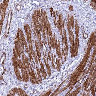 Immunohistochemistry-Paraffin: SYNPO2 Antibody [NBP2-48595]