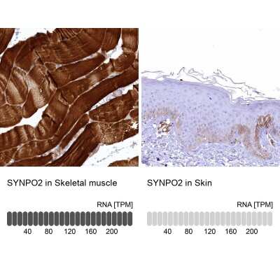 Immunohistochemistry-Paraffin: SYNPO2 Antibody [NBP2-48595]