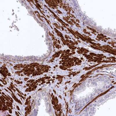 Immunohistochemistry-Paraffin: SYNPO2 Antibody [NBP2-48595]