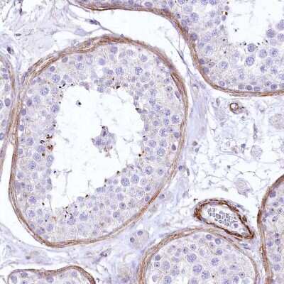 Immunohistochemistry-Paraffin: SYNPO2 Antibody [NBP2-48595]