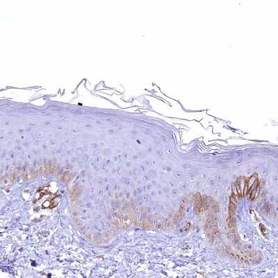 Immunohistochemistry-Paraffin: SYNPO2 Antibody [NBP2-48595]