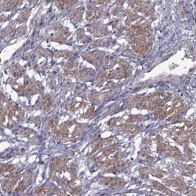 Immunohistochemistry-Paraffin: SYNPO2 Antibody [NBP2-57202]