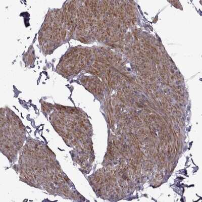 Immunohistochemistry-Paraffin: SYNPO2 Antibody [NBP2-57202]