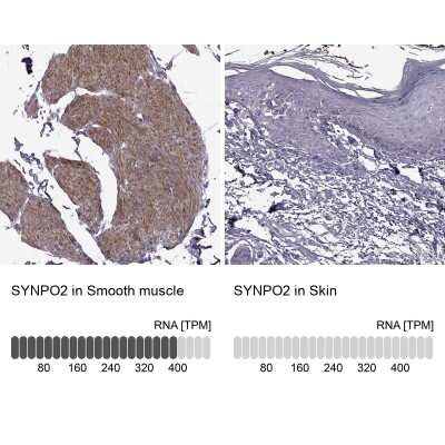 Immunohistochemistry-Paraffin: SYNPO2 Antibody [NBP2-57202]