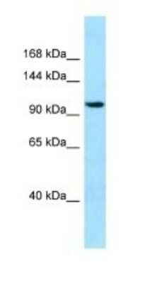 Western Blot: SYNPO2 Antibody [NBP1-98292]