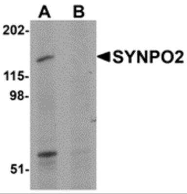 Western Blot: SYNPO2 AntibodyBSA Free [NBP2-82037]