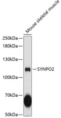 Western Blot: SYNPO2 AntibodyAzide and BSA Free [NBP2-93511]