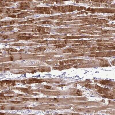 Immunohistochemistry-Paraffin: SYNPO2L Antibody [NBP2-33741]