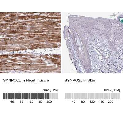 Immunohistochemistry-Paraffin: SYNPO2L Antibody [NBP2-33741]