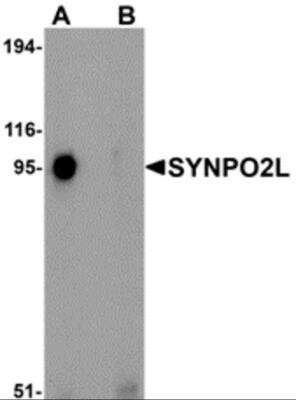 Western Blot: SYNPO2L AntibodyBSA Free [NBP2-82021]