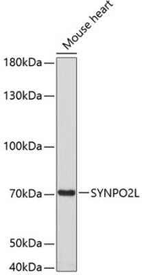 Western Blot: SYNPO2L AntibodyAzide and BSA Free [NBP2-94860]