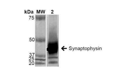 Western Blot: SYPL1 Antibody (EP10) [NBP2-59340]