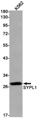 Western Blot: SYPL1 Antibody (S02-9K7) [NBP3-19976]