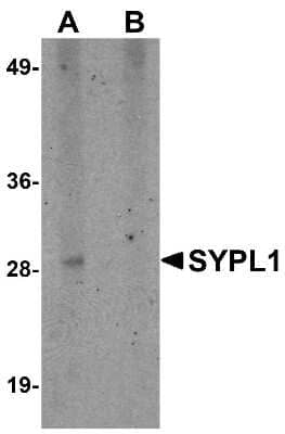 Western Blot: SYPL1 AntibodyBSA Free [NBP1-76316]