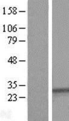 Western Blot: SYPL1 Overexpression Lysate [NBL1-16645]