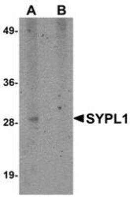 Western Blot: SYPL1 Antibody Blocking Peptide [NBP1-76316PEP]