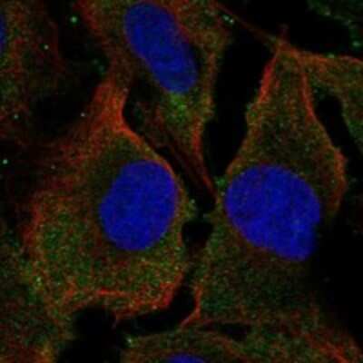 Immunocytochemistry/ Immunofluorescence: SYPL2 Antibody [NBP3-17628]