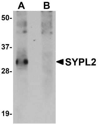 Western Blot: SYPL2 AntibodyBSA Free [NBP1-77362]