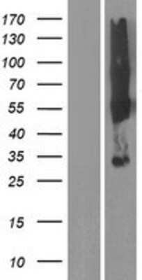 Western Blot: SYPL2 Overexpression Lysate [NBP2-08354]