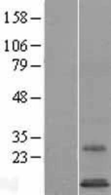 Western Blot: SYS1 Overexpression Lysate [NBL1-16646]