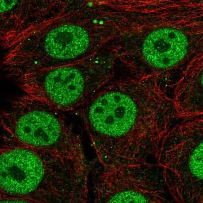 Immunocytochemistry/ Immunofluorescence: SYT10 Antibody [NBP2-31604]