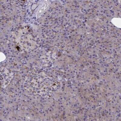Immunohistochemistry: SYT10 Antibody [NBP2-31604]