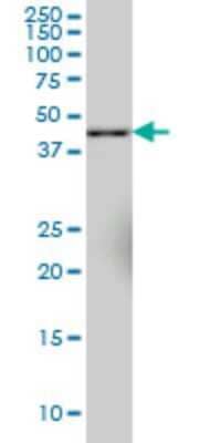 Western Blot: SYT11 Antibody (4E1) [H00023208-M03]