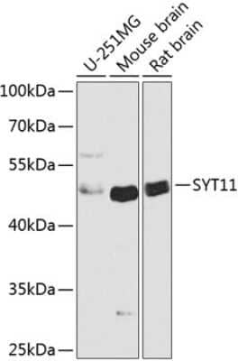 Western Blot: SYT11 AntibodyAzide and BSA Free [NBP2-93989]