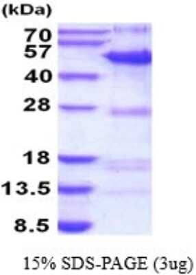 SDS-PAGE: Recombinant Human SYT11 His Protein [NBP2-52167]