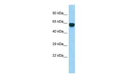 Western Blot: SYT14 Antibody [NBP3-09591]