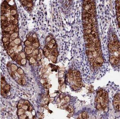 Immunohistochemistry-Paraffin: SYT15 Antibody [NBP2-30856]