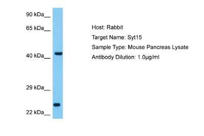 Western Blot: SYT15 Antibody [NBP2-85862]