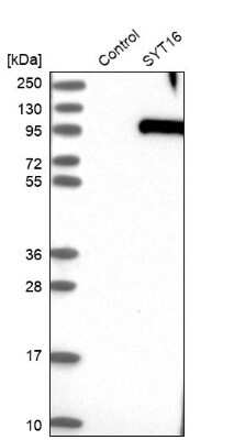 Western Blot: SYT16 Antibody [NBP1-85628]