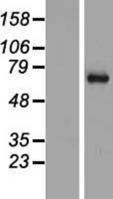 Western Blot: SYT16 Overexpression Lysate [NBP2-06104]