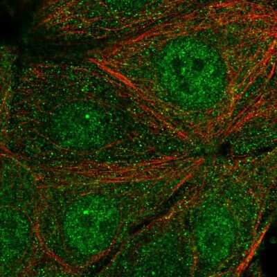 Immunocytochemistry/ Immunofluorescence: SYT17 Antibody [NBP2-58999]