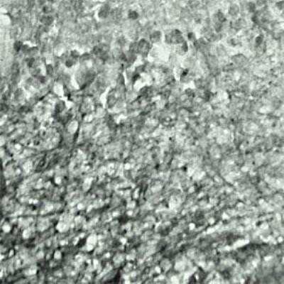 Immunohistochemistry: SYT17 Antibody - Azide and BSA Free [NBP1-03494]
