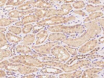 Immunohistochemistry-Paraffin: SYT17 Antibody [NBP2-97845]