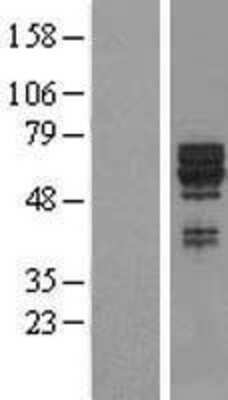 Western Blot: SYT17 Overexpression Lysate [NBL1-16650]