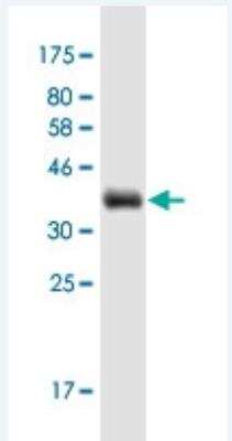 Western Blot: SYT7 Antibody (4H4) [H00009066-M01-100ug]