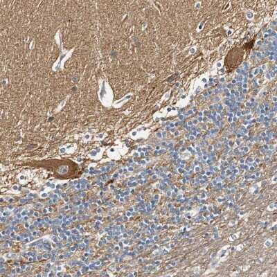 Immunohistochemistry-Paraffin: SYT7 Antibody [NBP1-81588]