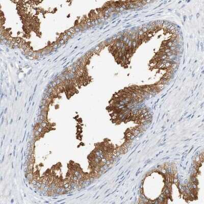 Immunohistochemistry-Paraffin: SYT7 Antibody [NBP1-81588]